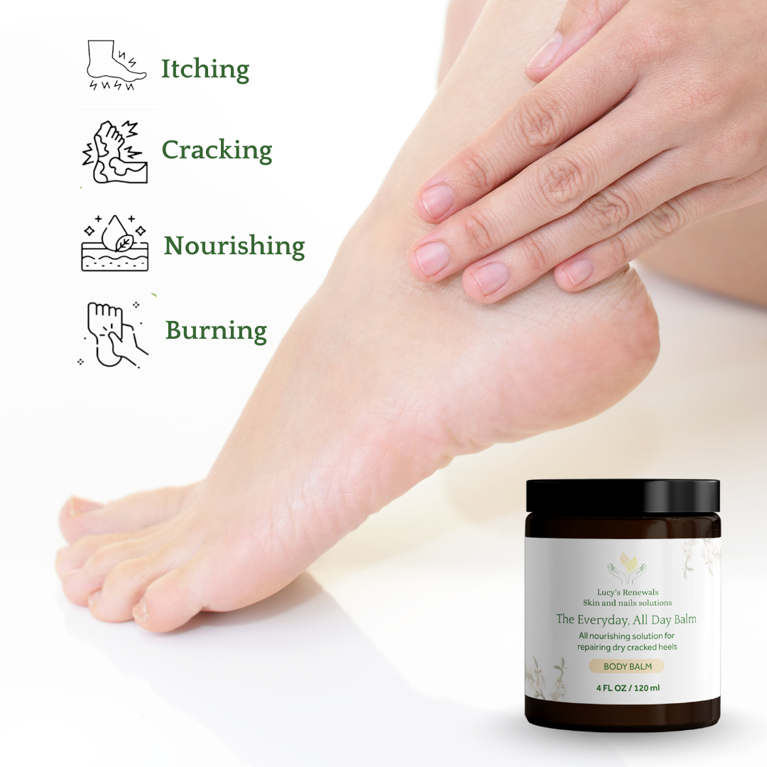 Water-Free Cracked Heels Repair Balm – Dry Skin Treatment – 100% Natural Ingredients